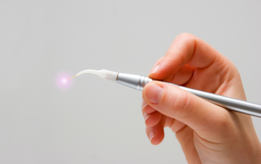 Woman hand holding dental laser